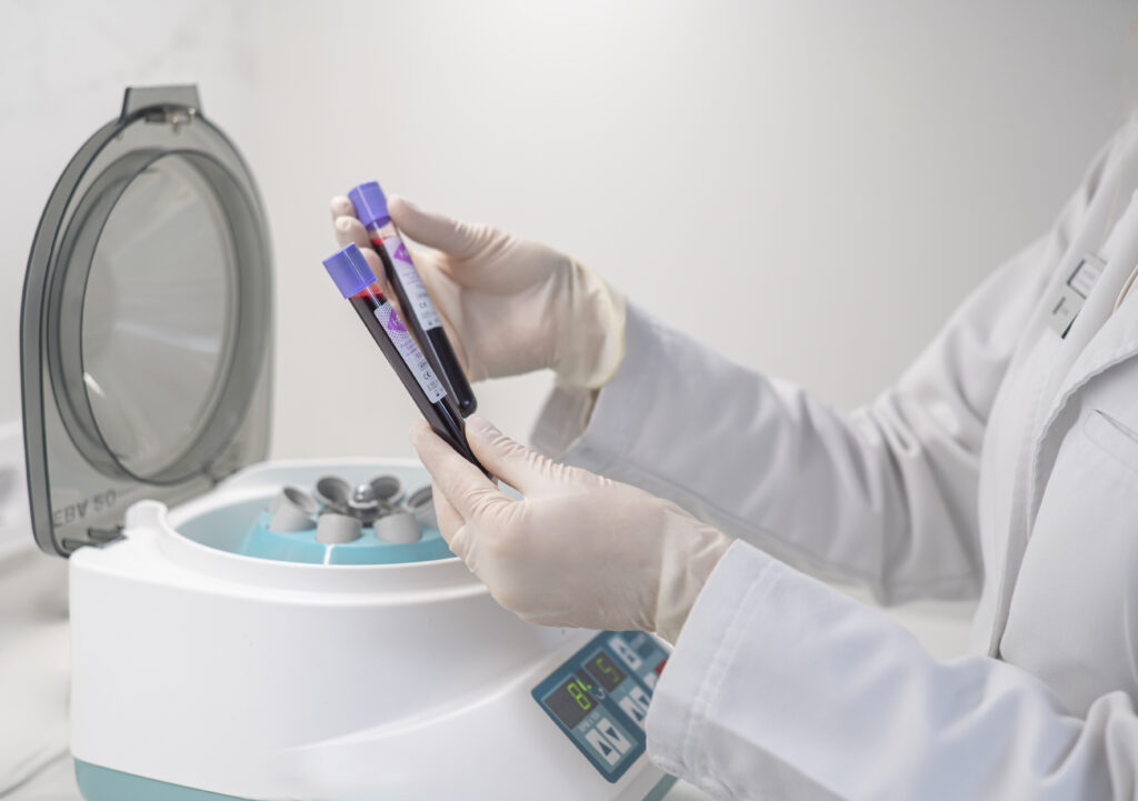 Kraujo plazmos procedūros (PRP plazmoliftingas, i-PRF)