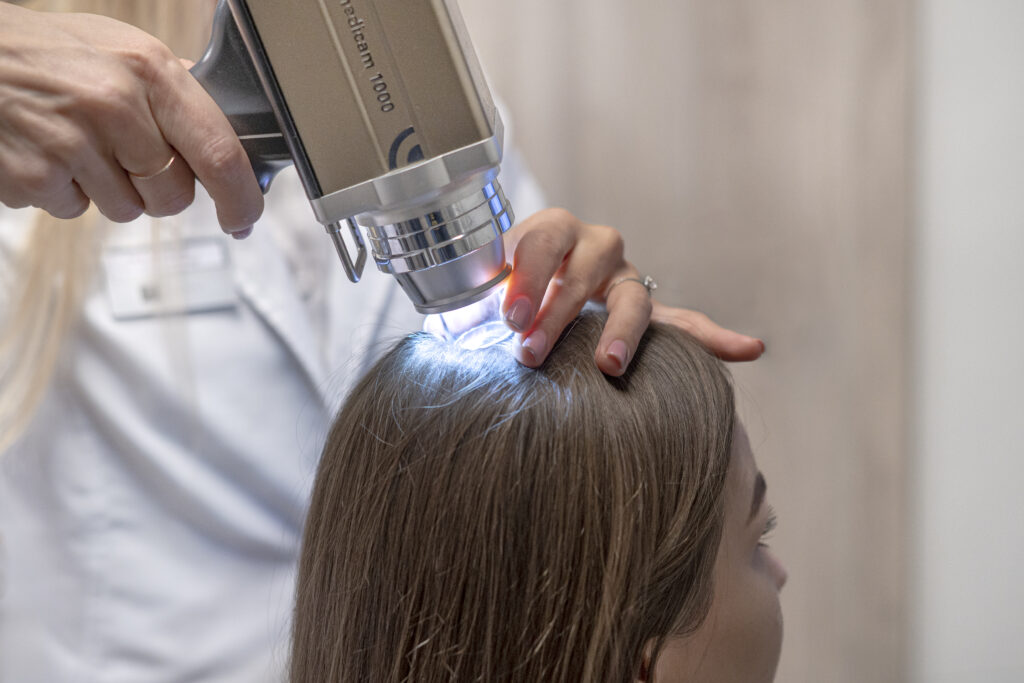 „TrichoScan” skaitmeninis plaukų svogūnėlių tyrimas