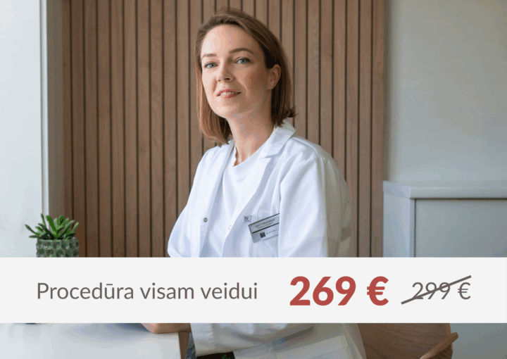 Secret RF mikroadatinis odos atjauninimas