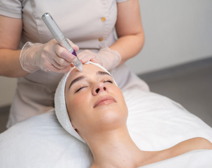 Kolageno indukcinė terapija veidui NANOPORE PEN mezopenu