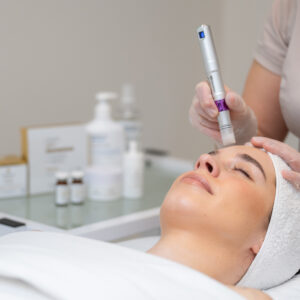 TOP procedūra! Jauninanti EXOSES LB egzosomų terapija atliekama mezopenu