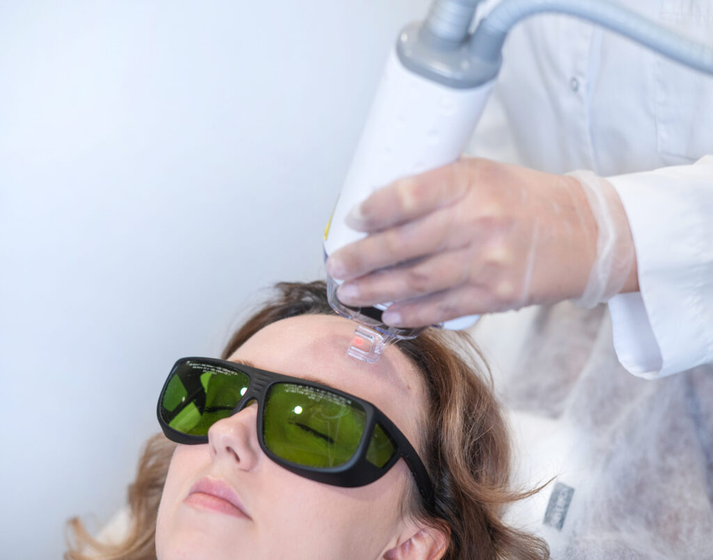 Aknės ir kitų randų gydymas lazeriu 